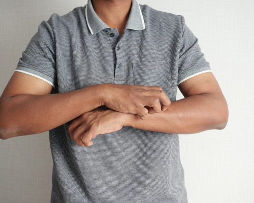 man itching his arm
